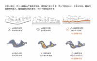 腰背酸痛&脊椎侧弯?床垫才是罪魁祸首!