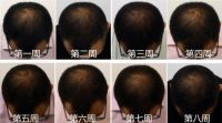 叮!CRESCINA科瑞西娜送你的头皮保养秘籍,请查收!