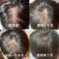 叮!CRESCINA科瑞西娜送你的头皮保养秘籍,请查收!