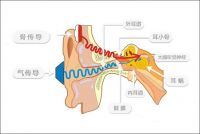 Sanag气传导耳机成为新选择